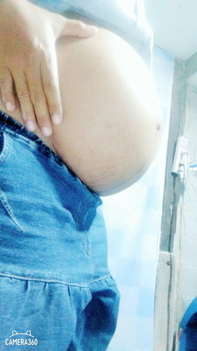 ท้องแตก