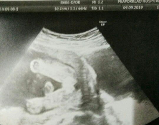 ใกล้จะได้เห็นหน้าแล้ว