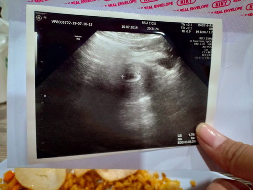 uk 6week janin belum kelihatan