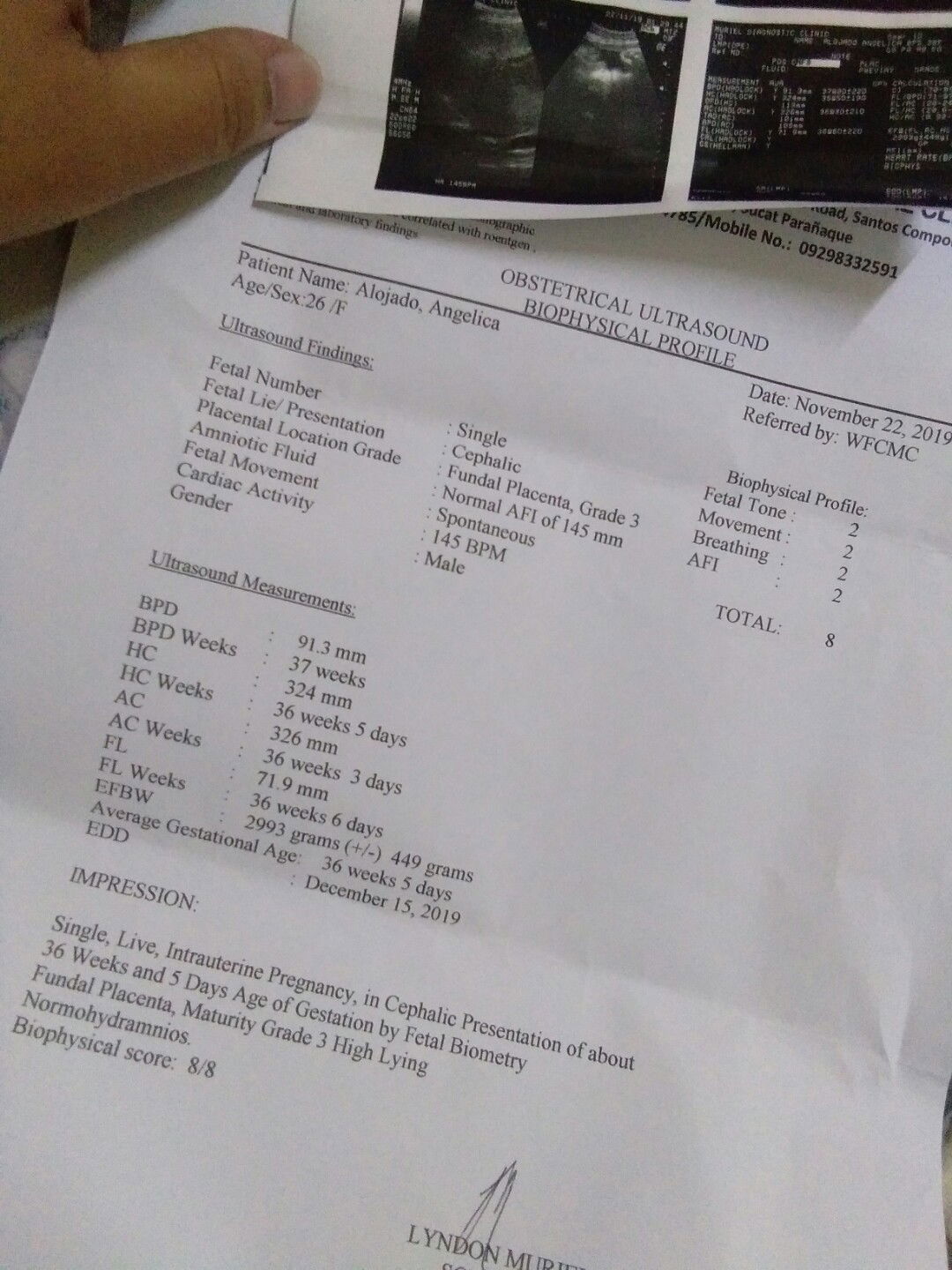 4th UTZ .. im 36 wiks and 5Days today ! Excited for my 3rd child finally its Baby Boy ???