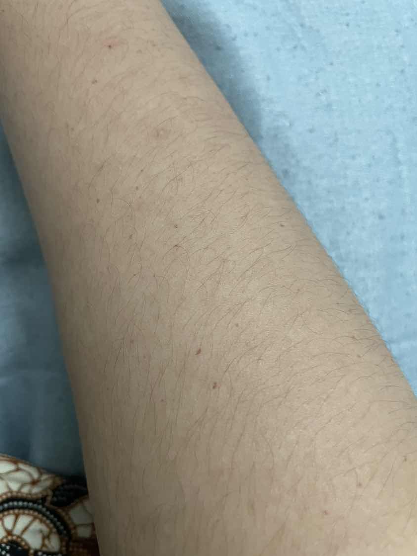 apa ni ya?