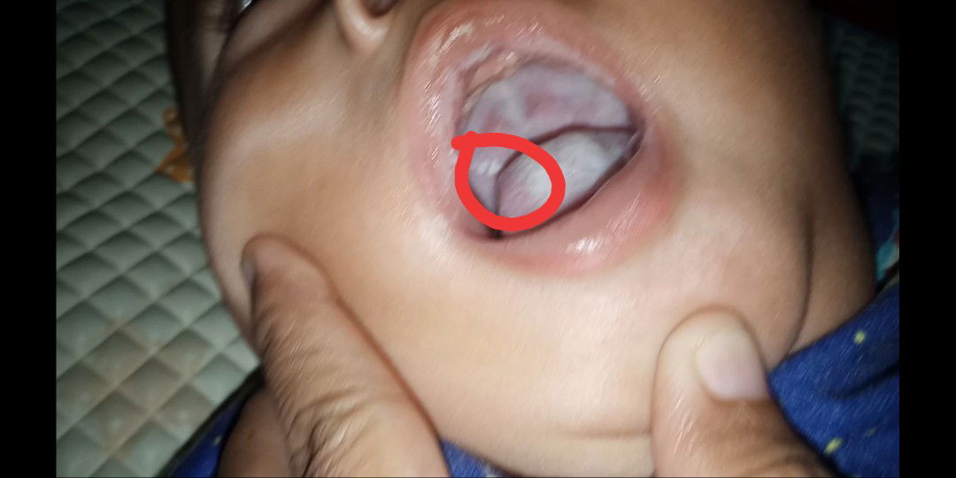 putih"dirongga mulut