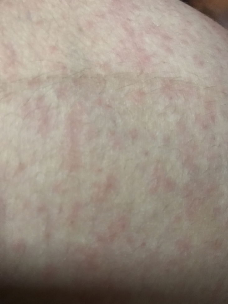 หมอนัดศุกร์นี้ควรไปหาก่อนหรือรอ