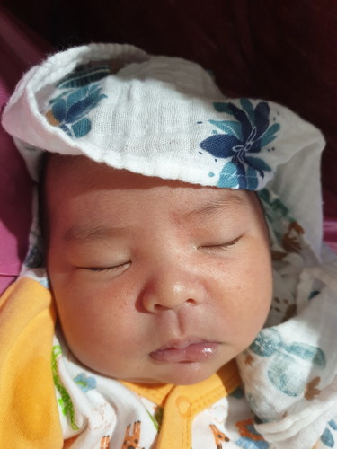 หน้ามีผดขึ้น บ้านไหนเป็นทำอย่างไรบ้างคะ