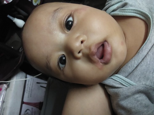 Pula sa mukha ni baby