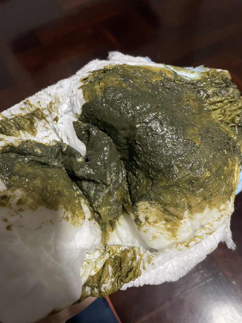 อึสีนี้ผิดปกติไหมคะ