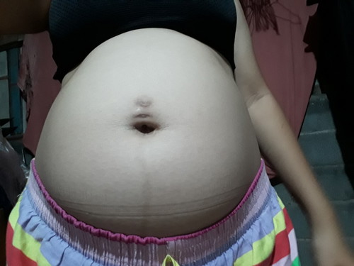22week