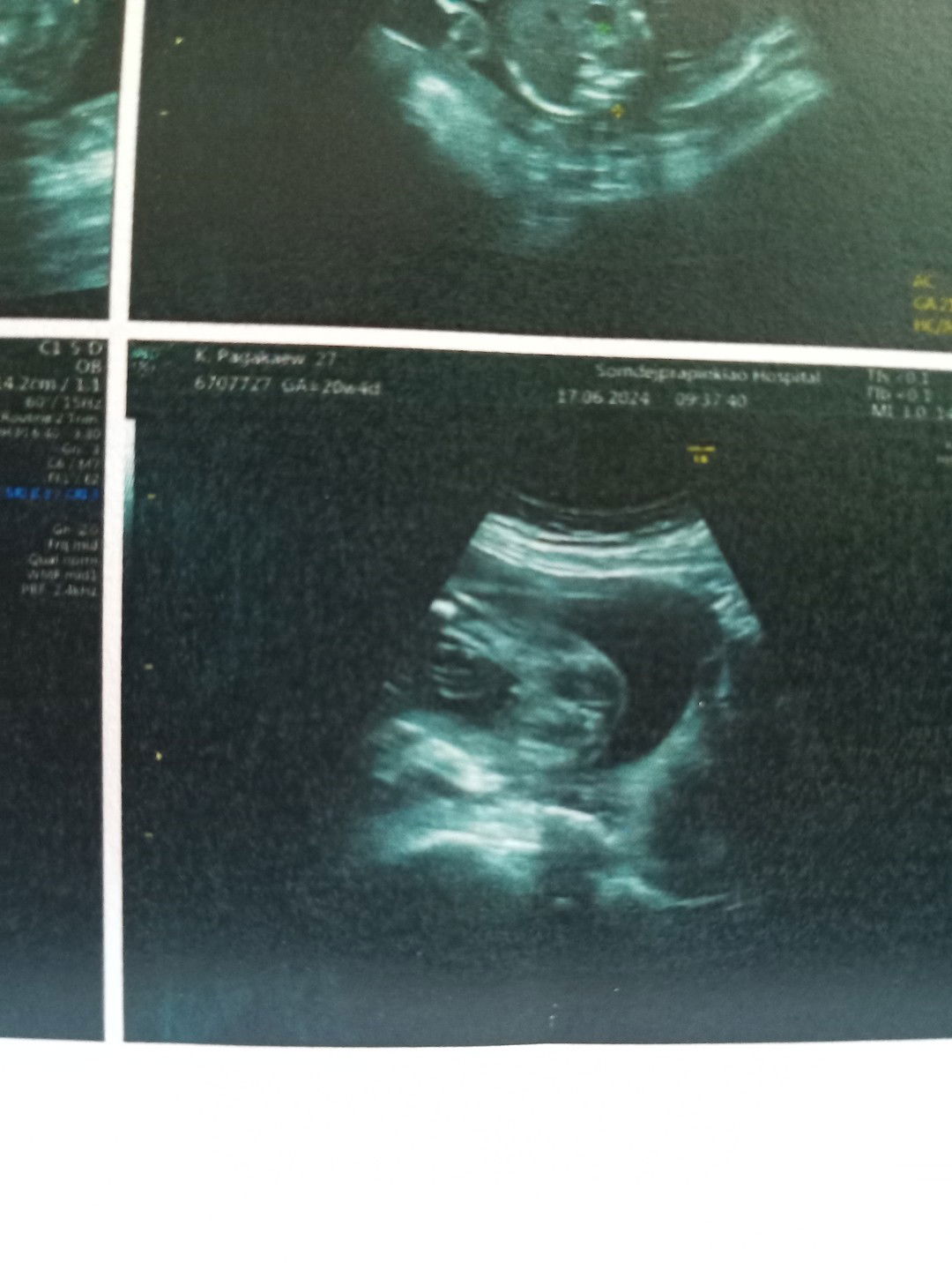 Pagakaew Khokwilai profile icon