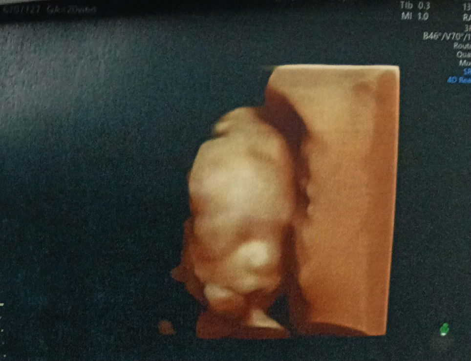 Pagakaew Khokwilai profile icon