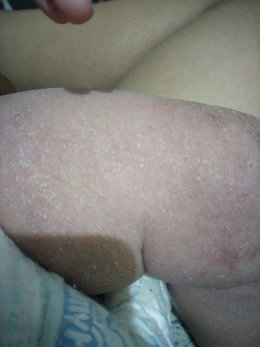 kulit bayi
