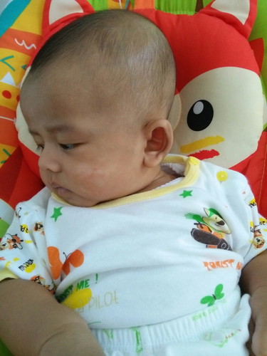 merah merah di pipi