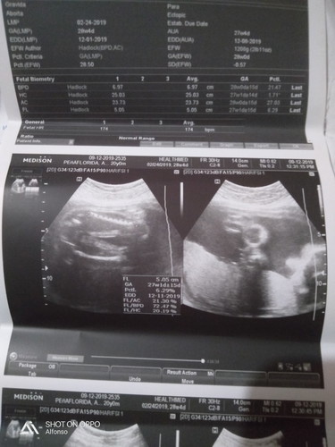 Accuration of Gender and Weight of Baby