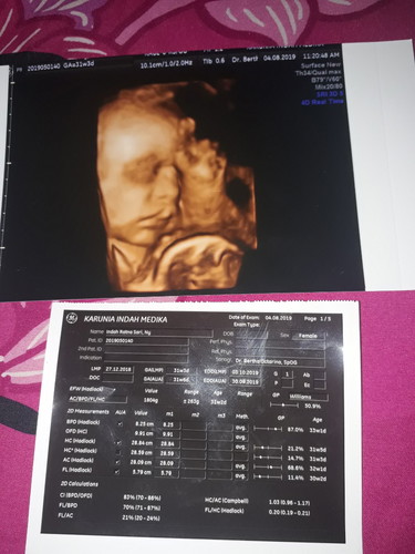 plasenta berada dibawah