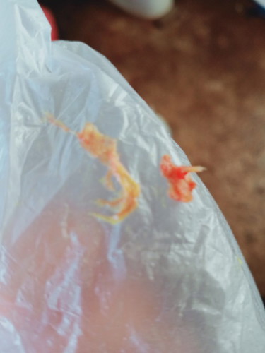 แม่ๆคะเมื่อเช้าน้องอึแล้วมีแบบในรูปออกมาด้วยต้องไปหาหมอมั้ยคะแต่น้องกินนมได้ปกติไม่มีอาการอะไรเลยค่ะ