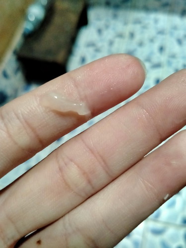 แบบนี้ปกติไหมค่ะ