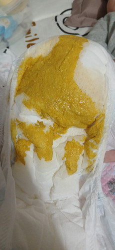 อึลูกปกติไหม