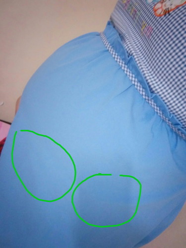 28+3แม่บ้านไหนเป็นเหมือนกันบ้างค่ะช่วยกันแสดงความคิดเห็นหน่อยนะค่ะ