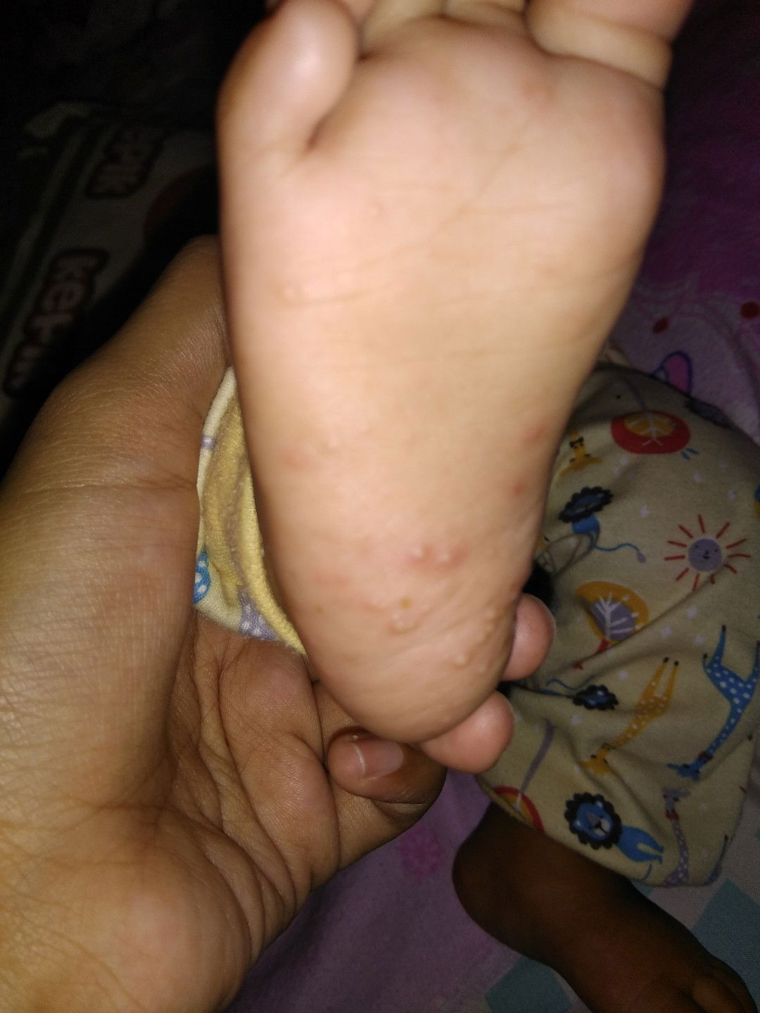 Bintik Merah Putih Pada Kaki Bayi