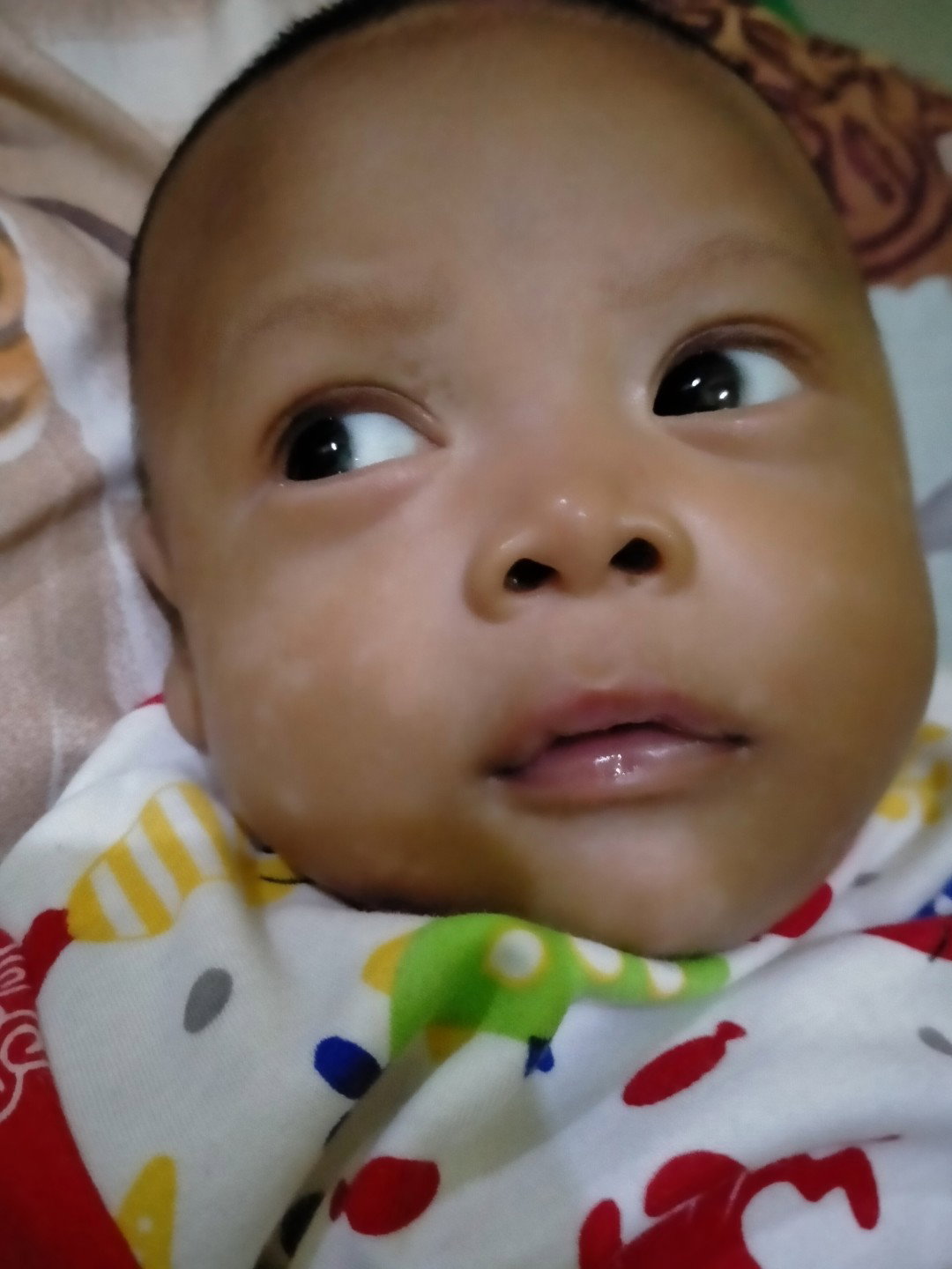 bekas beruntusan di pipi bayi