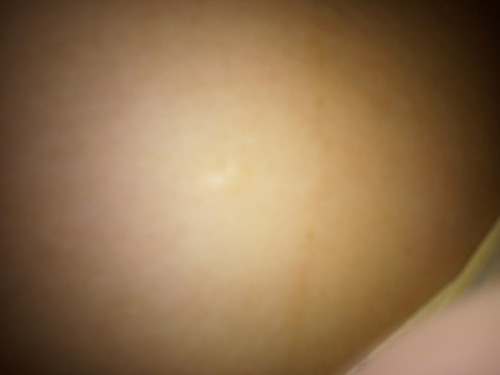 เส้นตรงกลาง