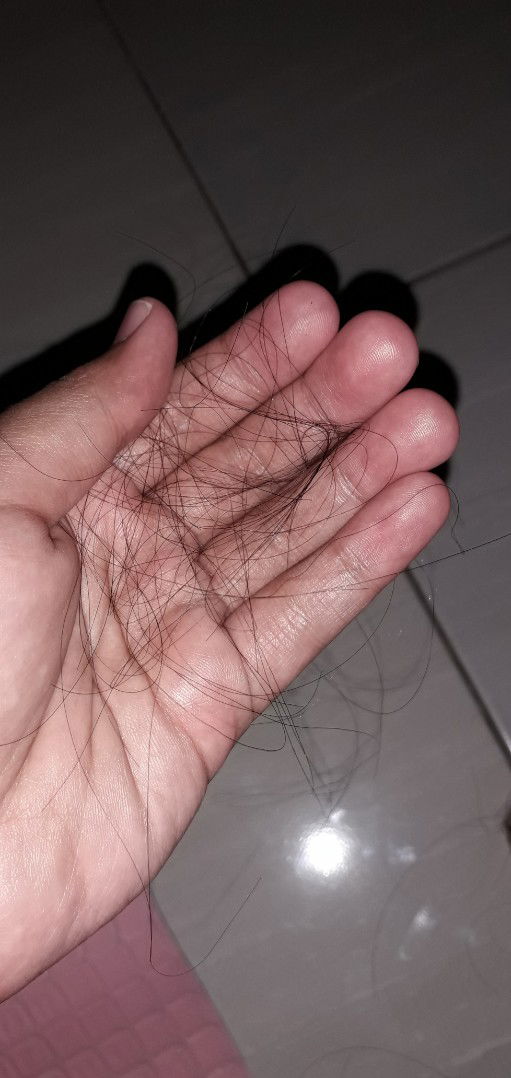 Rambut rontok selama menyusui.