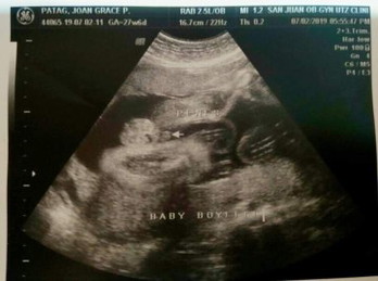BOY or GIRL??