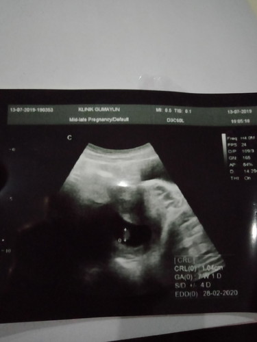 setiap USG hpl sllu mundur