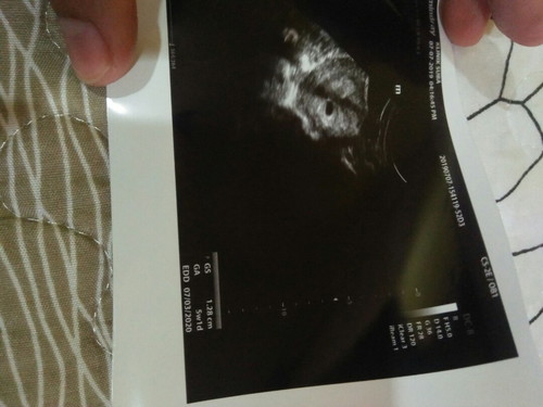 scan baby