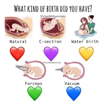 What kind of birth did you have?