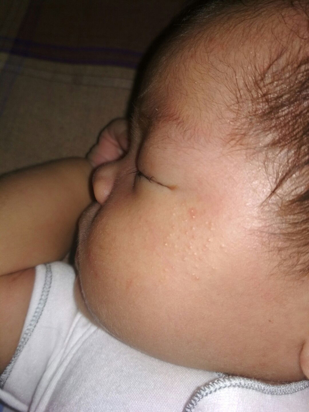 bintik2 merah pada wajah bayi