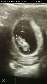 หนูเครียดมากค่ะ