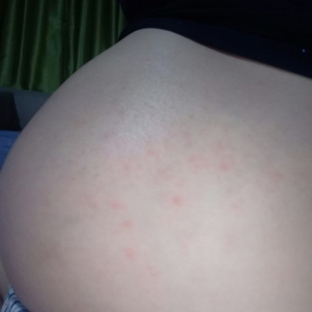 หมั่นเขี้ยว