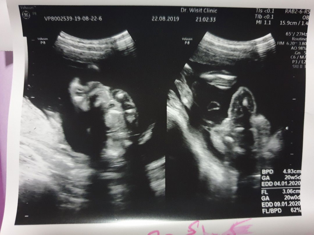 ตัวเล็ก