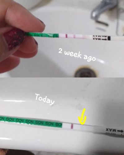 คือตอนแรกที่เราตรวจฮอร์โมนสูงมาก