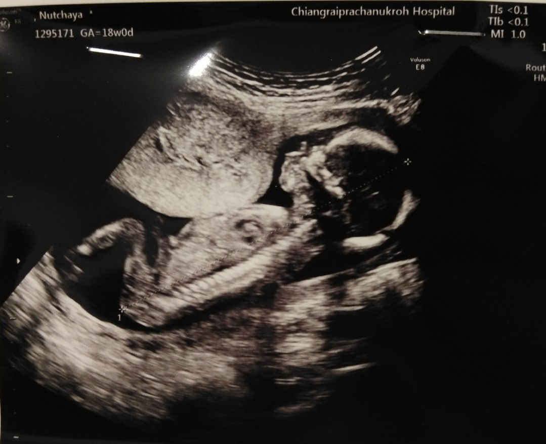 Natchaya Kotipang profile icon