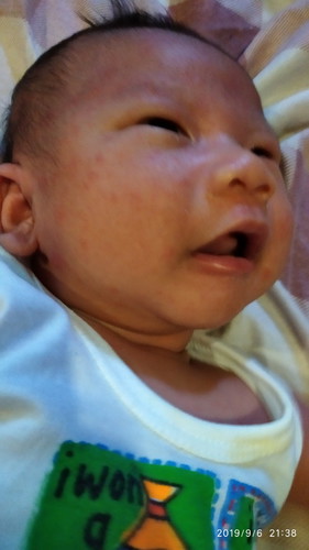 Physiogel cream or lotion