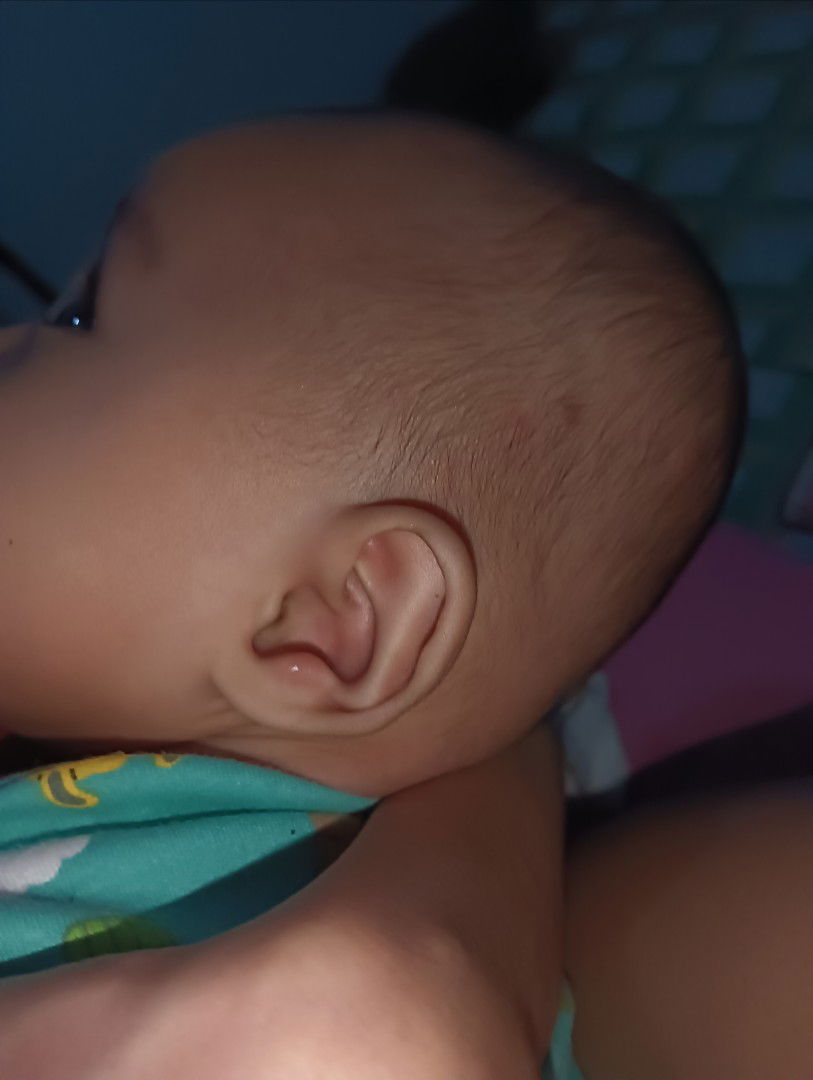 Telinga merah dan bengkak