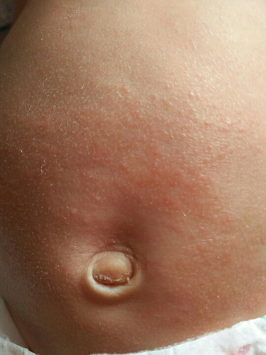 สอบถามคะ