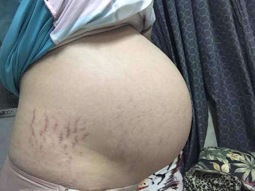 Any advice para mabilis mapaanak?