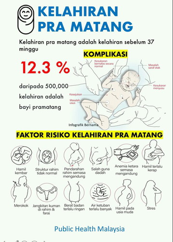 Kelahiran Bayi Pra Matang / Pre Mature Baby