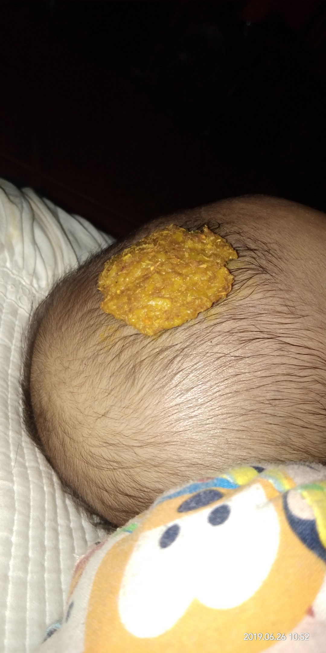 Mohon sarannya Bunda