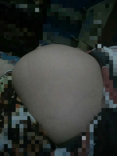 33w6d