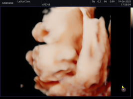 Kittiyapron Sa profile icon