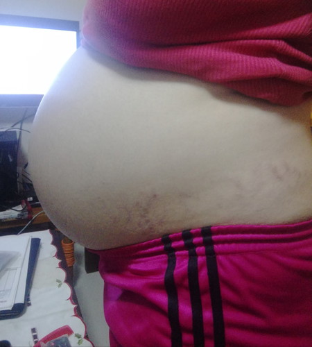 38 wks..
