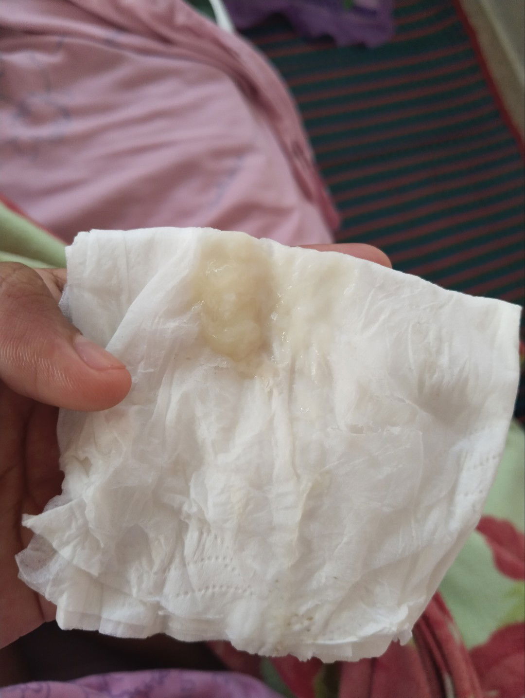 อันนี้มูกใสรึป่าวคะ หรือตกขาว