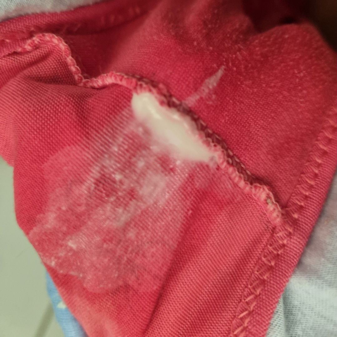 Mucus plug atau keputihan biasa?