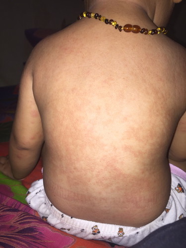 Kulit bayi