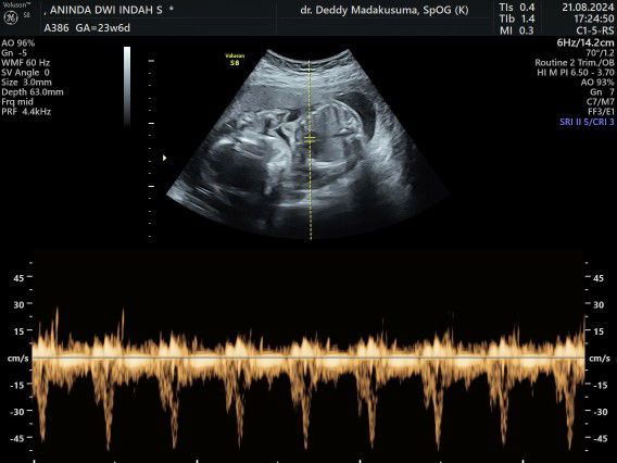 Aninda Dwi Indah saputri profile icon