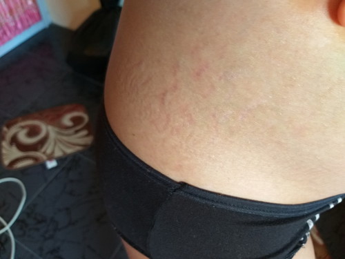 แม่กลัวรอยแตก 31w2d