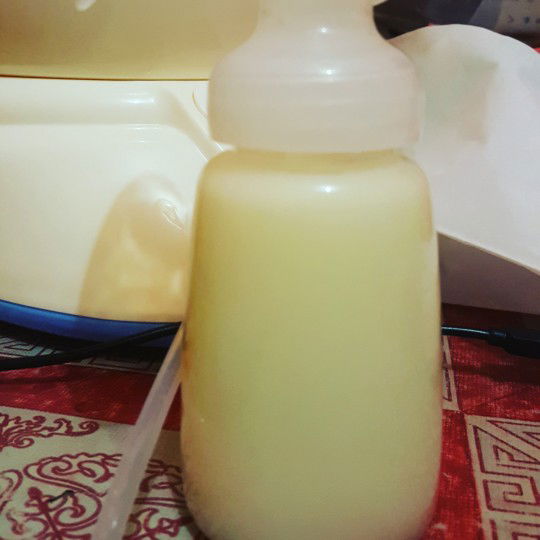 apa beda asi kuning dan putih bunda